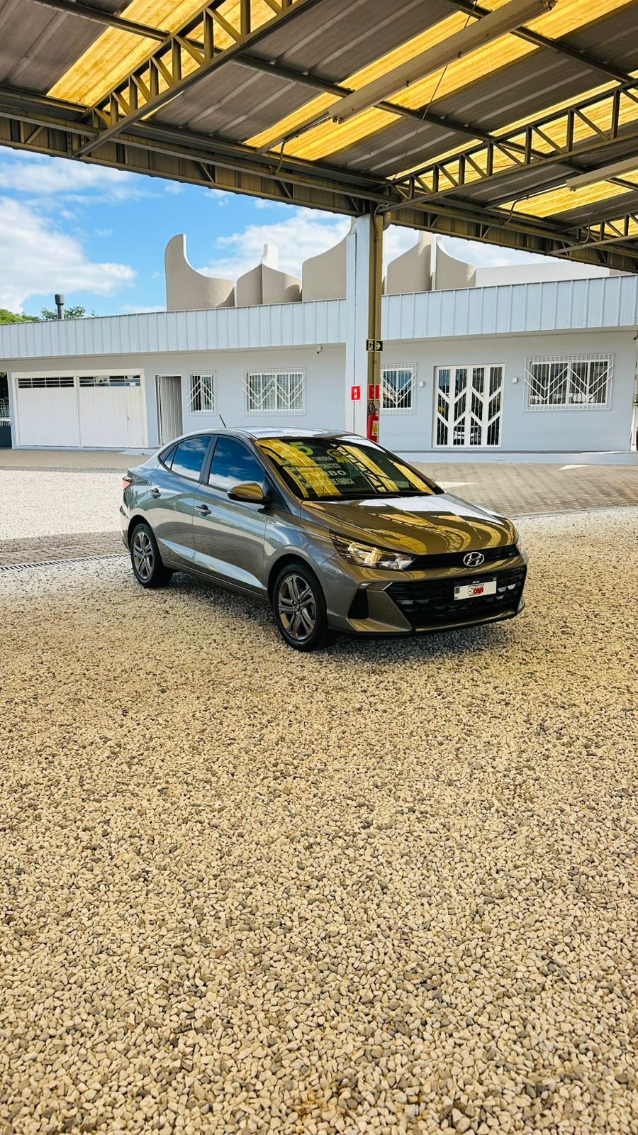 
Hyundai HB20S 2024/2025 completo									